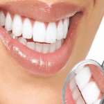 انتخاب بهترین کلینیک کامپوزیت دندان در کرج