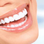 بلیچینگ دندان با بیمه آیا امکان پذیر است؟
