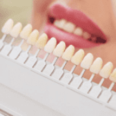 بهترین رنگ لمینت دندان را چگونه انتخاب کنیم؟ | راهنمای جامع رنگ لمینت
